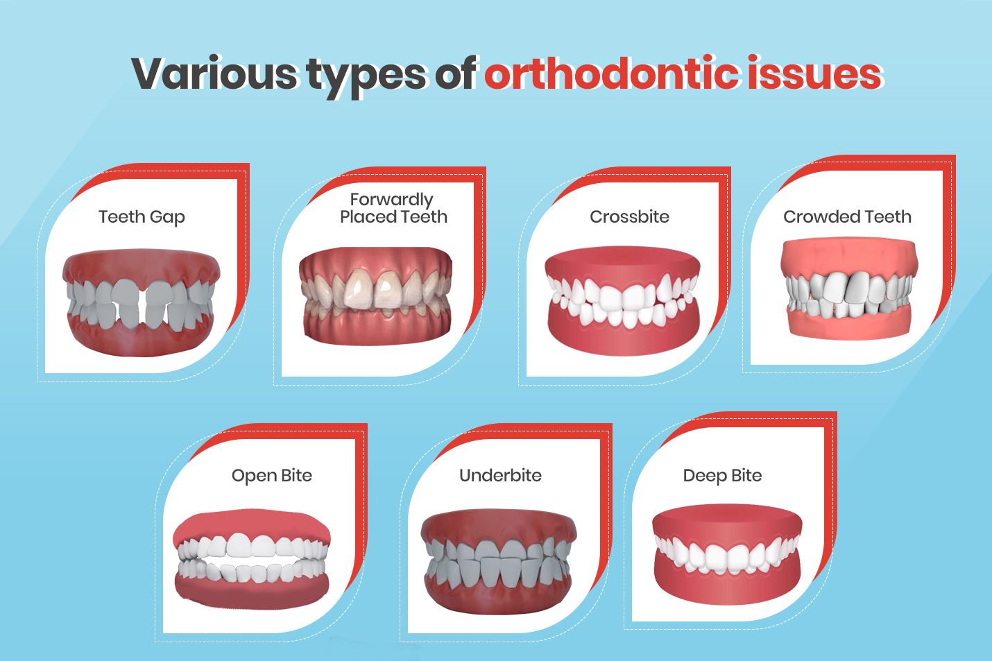 All You Need To Know About Orthodontics_infographics.jpg
