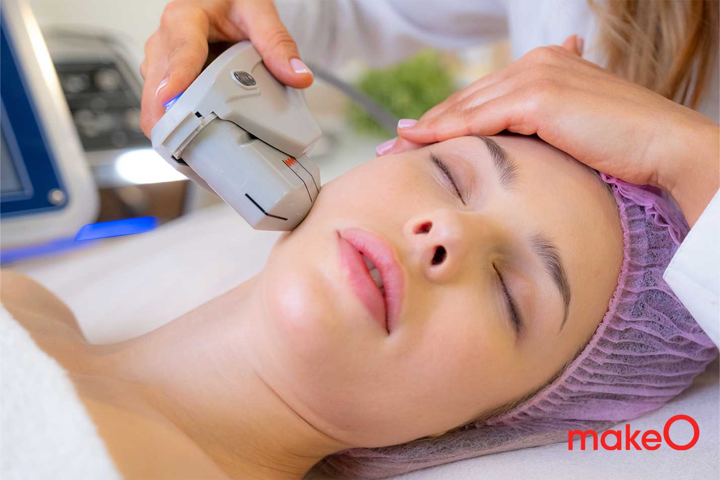 Laser treatment for face cost sales