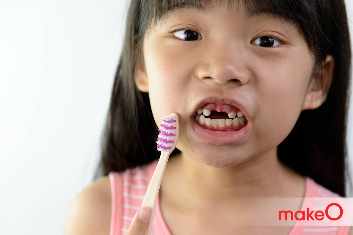 Dealing with a Cracked Tooth 4 Treatment Options