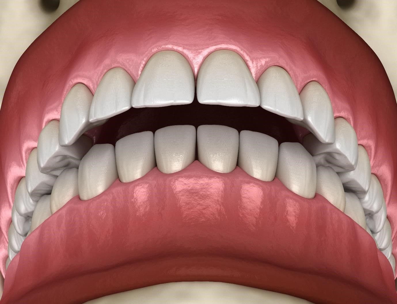 Teeth Problems: 10 Common Dental Issues & How to Fix Them