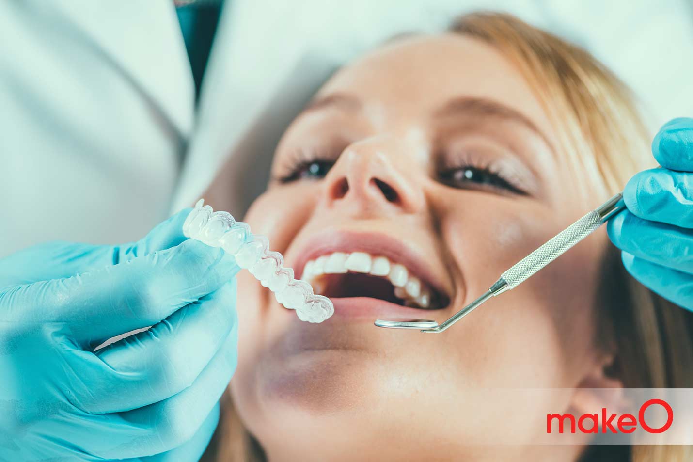 Teeth Whitening for Sensitive Teeth All you need to know