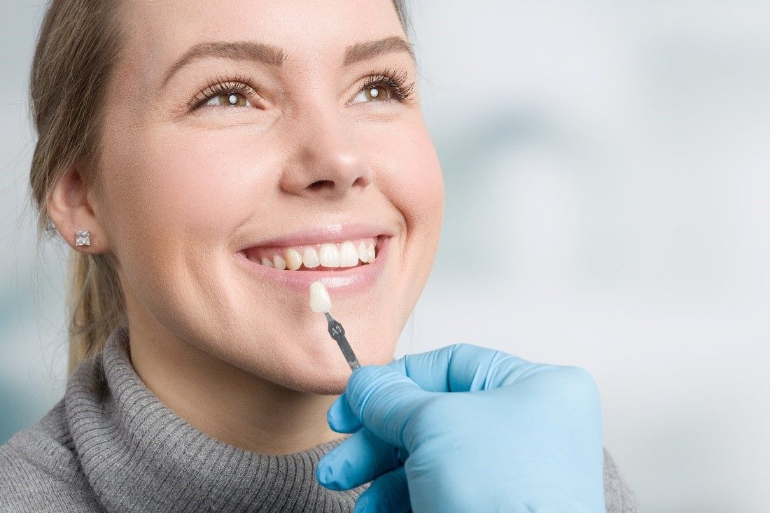 Teeth Veneers Cost, Benefits, Procedure All you need to know